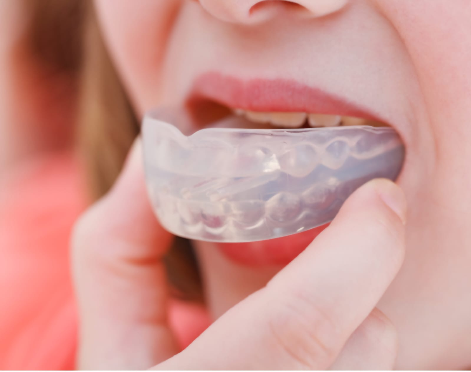 Teeth Grinding Management