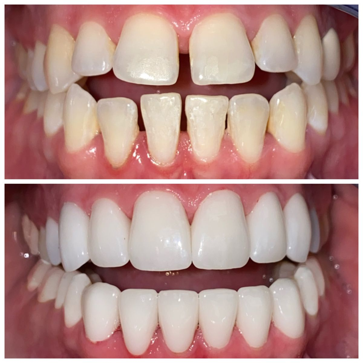 Smile Makeovers at Lebanon Dental Care Clinic in Mombasa, Kenya